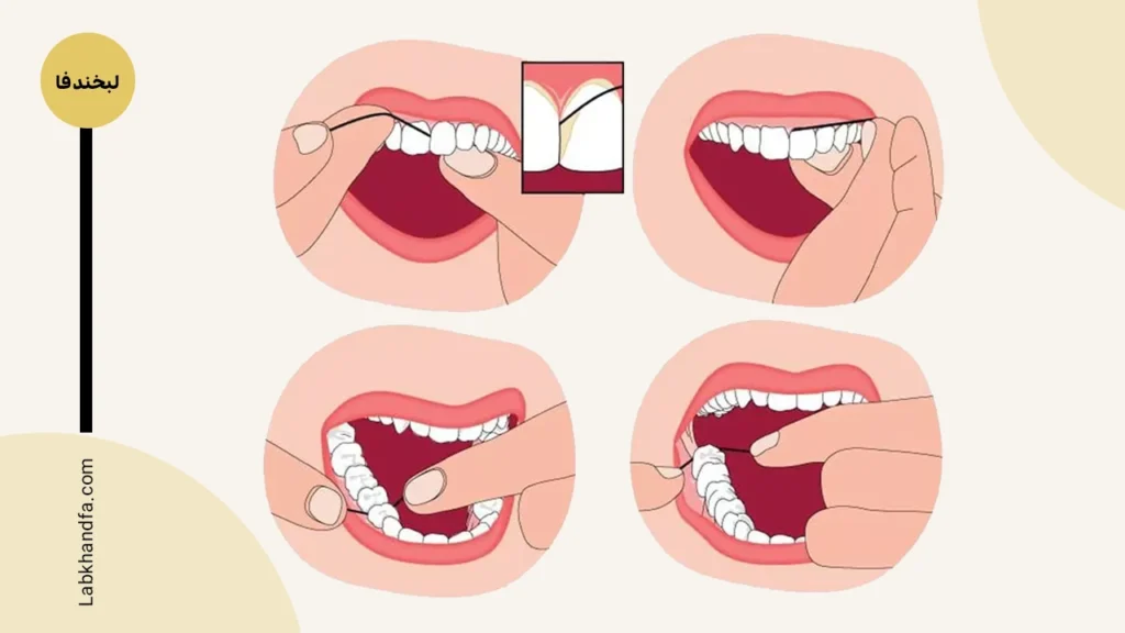بهداشت دهان و دندان نخ دندان کشیدن 