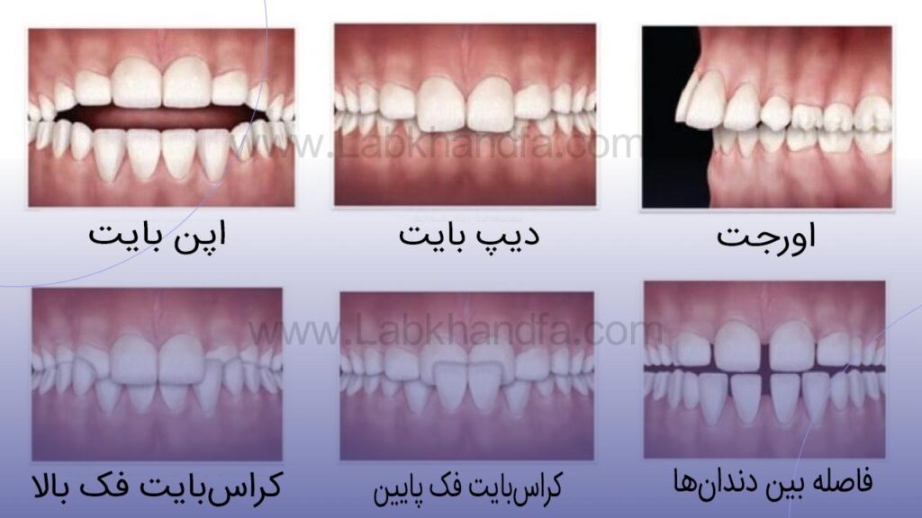 مشکلات ارتودنسی دندان