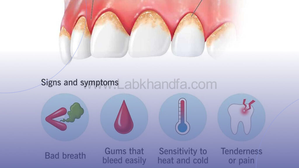 علائم بیماری لثه